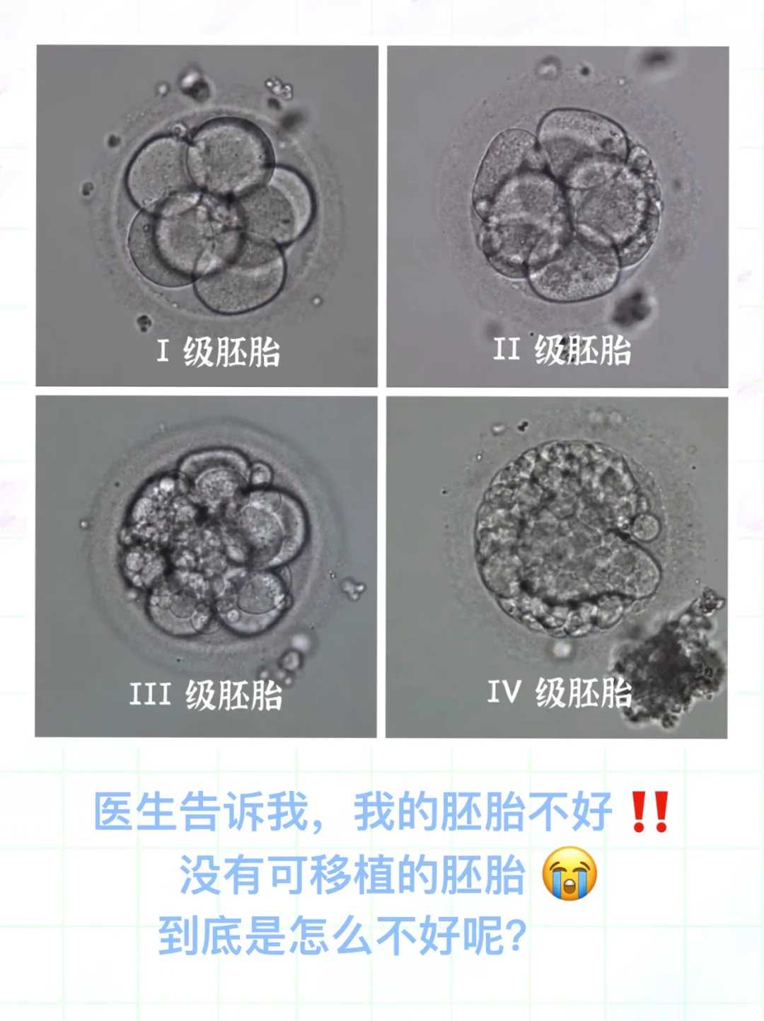 2026年供卵咨询新趋势：孕妈妈的3步成功指南