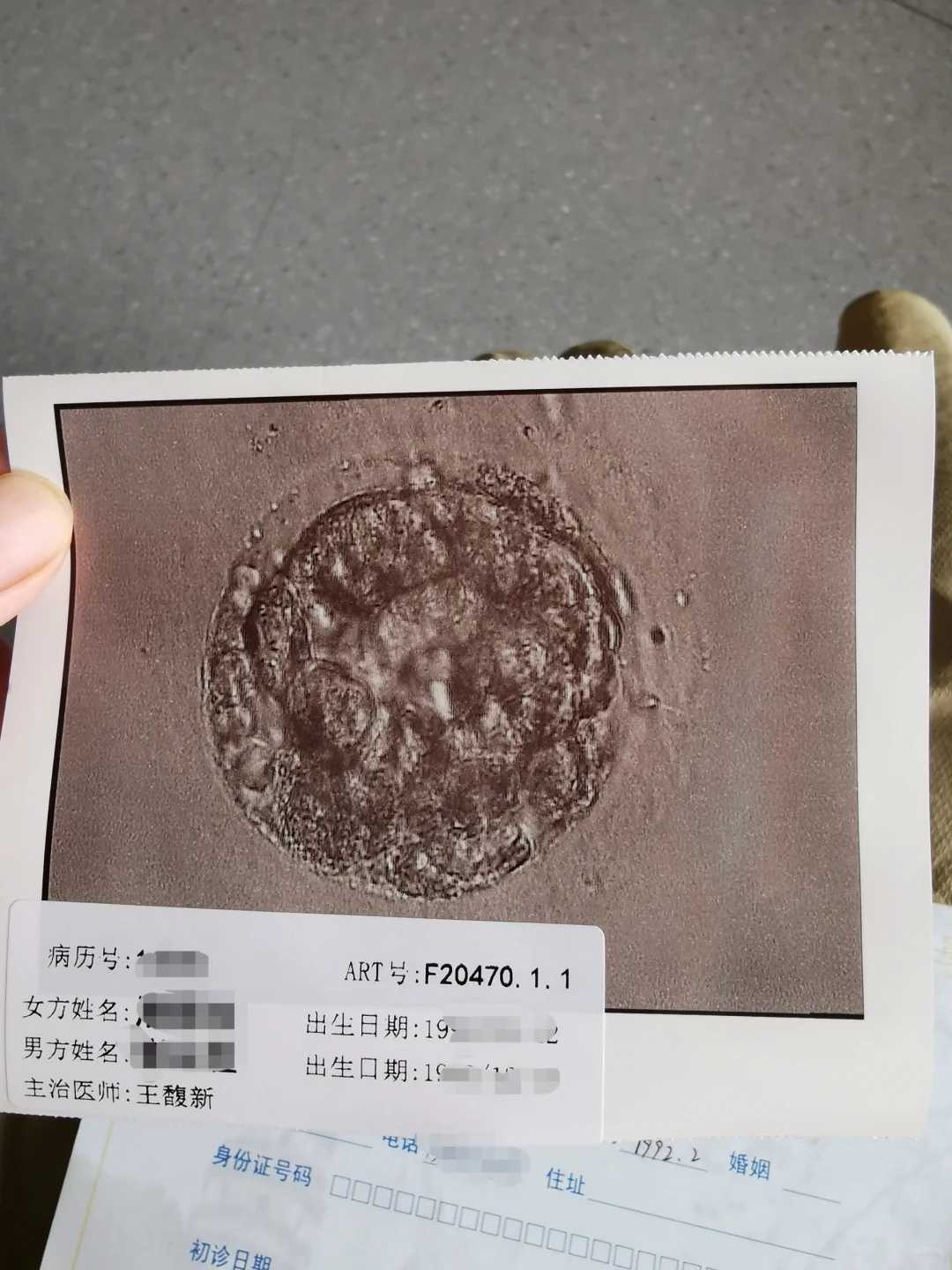 为什么90%的代孕家庭忽略咨询？专家揭示3大关键要素